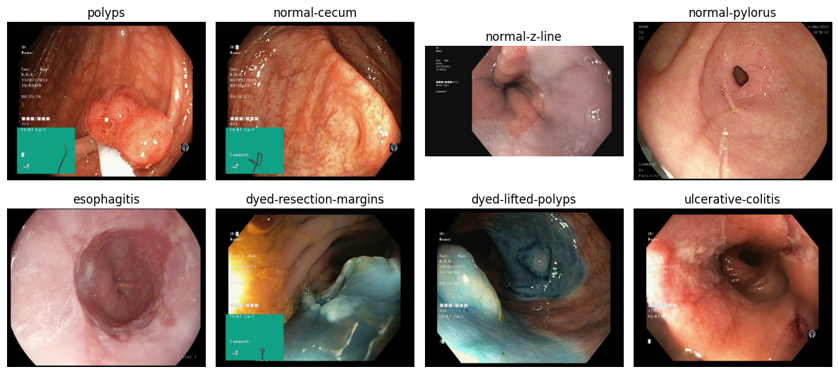 Gastrointestinal Disease
